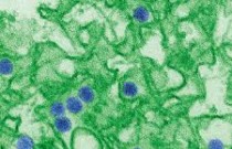 Cientistas confirmam circulação de vírus mayaro em humanos