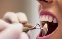 Entenda os riscos e complicações de extrair o dente siso