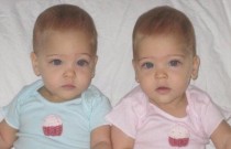 Elas cresceram! veja como estão as gêmeas mais belas do mundo
