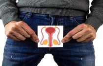 Diagnostico tardio do câncer causa 500 amputações de pênis no Brasil todo ano