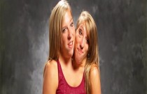 10 fatos interessantes sobre as gêmeas siamesas Abby e Brittany Hensel