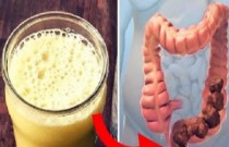 Aprenda como limpar seu intestino com 4 dicas caseiras