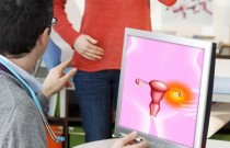 Como identificar e tratar o cisto no ovário