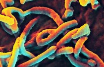 Diagnóstico rápido do ebola pode ser possível com nova tecnologia