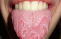 Conheça 9 doenças que se manifestam pela boca