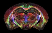 Nova ressonância magnética tem imagens milhões de vezes mais nítidas