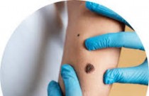 Câncer de pele: Nova vacina pode estar chegando e reduz o risco de morte