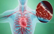 Cateterismo cardíaco - o que é, e como é o procedimento?