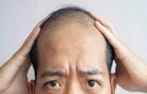 Cientistas descobrem novo mecanismo para crescimento de cabelos