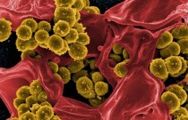 Antibiótico que mata superbactérias descoberto em micróbios do solo da Carolina do Norte
