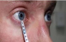 Síndrome do olho seco - ausência de lágrimas