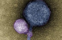Bizarro: vírus vistos ‘mordendo’ outros vírus, como pequenos vampiros
