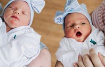 Gêmeas raras nascem em partos e dias diferentes