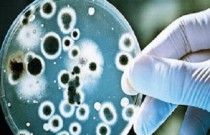 12 famílias de superbactérias que estão ameaçando à humanidade