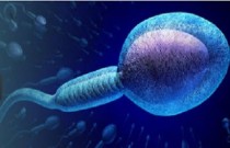 Azoospermia - ausência de espermatozoides na ejaculação