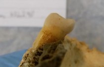 Cientistas extraem genes de dentes de 4000 anos para ver impacto na dieta humana