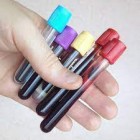 Teste de sangue pode detectar risco de morte por insuficiência cardíaca