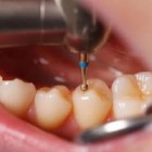 Bicho papão ou barulho de maquininha do dentista, o que mais te assusta?