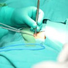 Mulher com mais de 100 larvas na boca recebe tratamento
