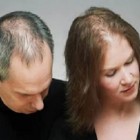 Queda de cabelo pode está relacionada à distúrbios emocionais.
