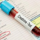 Está com a creatinina alta? Saiba o que isso significa!