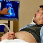 Transplante de útero se torna realidade e agora homens também poderão engravidar