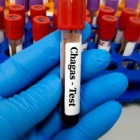 Projeto busca tratar doença de chagas perto da casa dos pacientes