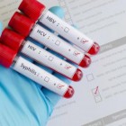Gonorreia está se tornando cada vez mais resistente a antibióticos, alerta OMS
