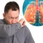 Tuberculose - doença poderosamente transmissível e infecto-contagiosa