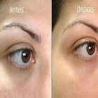 Você tem olheiras? Quer acabar com elas?