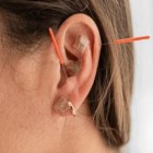 Os magníficos resultados obtidos com a acupuntura auricular