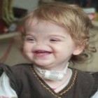 Menina nasce sem nariz e criará prótese por impressora 3D