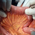 8 órgãos do corpo humano que a ciência já consegue criar em laboratório