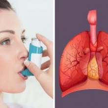 Bronquite asmática: o que é, sintomas e tratamento