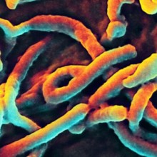 Diagnóstico rápido do ebola pode ser possível com nova tecnologia