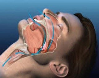 Apneia obstrutiva do sono - como saber se você sofre dessa doença?