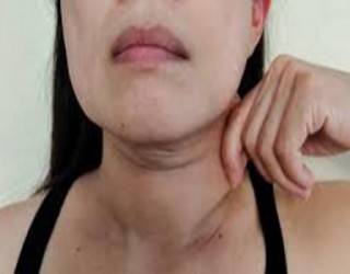 Personalidade histriônica - como identificar uma pessoa Portadora desse transtorno?