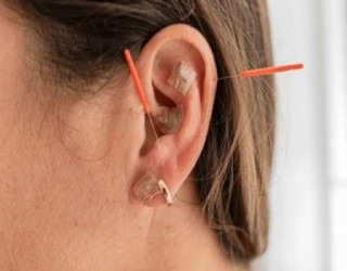 Os magníficos resultados obtidos com a acupuntura auricular