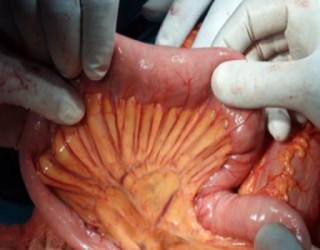 8 órgãos do corpo humano que a ciência já consegue criar em laboratório