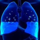 Como identificar e tratar a água no pulmão