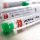 Varíola dos macacos avança no Brasil