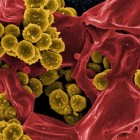 Antibiótico que mata superbactérias descoberto em micróbios do solo da Carolina do Norte