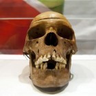 Crânios africanos pilhados em domínio colonial alemão são comparados com parentes vivos