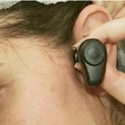 Técnica inédita recupera audição de deficientes auditivos