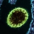 Vírus Nipah, existe risco de uma nova pandemia?