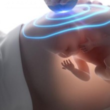 Ultrassom na gravidez: que doenças detecta, quantos se faz e diferentes tipos