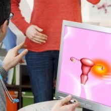 Como identificar e tratar o cisto no ovário