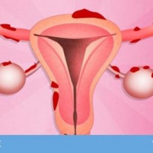 7 Dicas para viver melhor com Endometriose