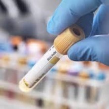 Espanha confirma as duas primeiras mortes por hepatite aguda infantil