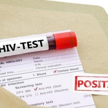 Como é o trabalho de médicos que dão o diagnóstico de HIV positivo?